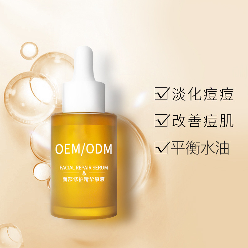 兰州市_祛痘精华原液OEM